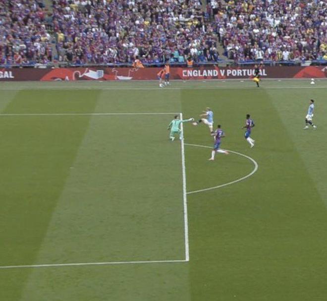 官方：毕尔巴鄂竞技前锋桑纳迪接受了右膝半月板手术（官宣：毕尔巴鄂竞技前锋桑纳迪完成右膝半月板手术）